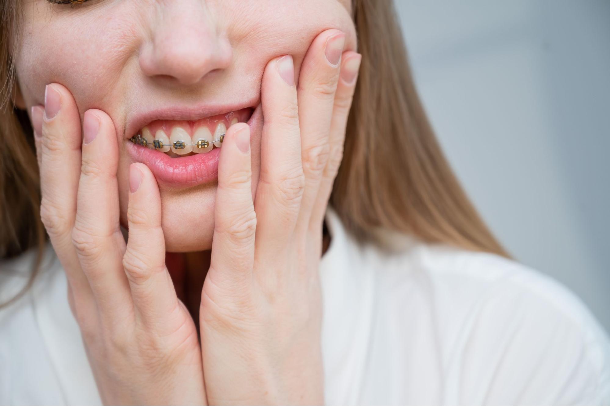 10 Common Braces Issues and How To Handle Them